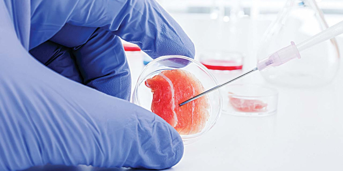 Stem Cells Lupus Treatment: A New Era of Hope for Autoimmune Patients